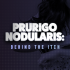 Prurigo Nodularis: Behind the Itch